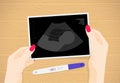 Baby ultrasound picture in woman hands on table