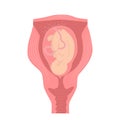 Baby in uterus during pregnancy - anatomical. Vector illustration