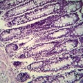 Bacillary dysentery, light micrograph Royalty Free Stock Photo