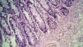 Bacillary dysentery, light micrograph Royalty Free Stock Photo