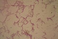 Bacillus anthracis anthrax 200x