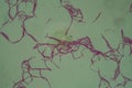 Bacillus anthracis anthrax 200x