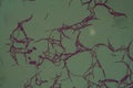 Bacillus anthracis anthrax 200x