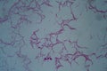 Bacillus anthracis anthrax 200x