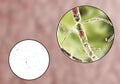 Bacillus anthracis, light micrograph and illustration