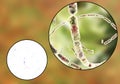 Bacillus anthracis, light micrograph and illustration