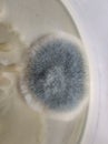 Bacillus and Aspergillus fumigatus growing on nutrient agar medium