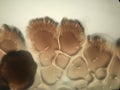 Bacicclus genus bacteria growing in round shaped colonies