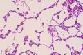 Bacillus gram positive stain under microscope view. Bacillus is rod-shaped bacteria