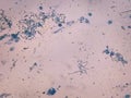 Bacillus megatherium microscopic gram staining