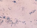 Bacillus megatherium microscopic gram staining