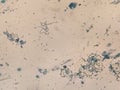 Bacillus megatherium microscopic gram staining