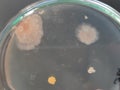 Bacillus and other bacteria and fungi growing on nutrient agar medium