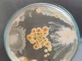 Bacillus subtilis other bacteria and fungi colonies on saboraud dextrose agar medium