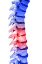 Back pain Royalty Free Stock Photo