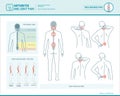 Back pain infographic