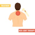 Back pain vector illustration. Red light therapy