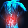 Back problems, pain, sciatica, spine