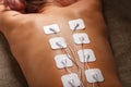 Muscle stimulator with electrodes, bacBack and shoulder massage with a muscle stimulator with attached electrodes along the spine Royalty Free Stock Photo