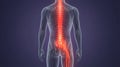 Back view of human spine with sciatic nerve inflammation highlighted in orange Royalty Free Stock Photo