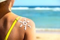 Back view of young woman tanning at the beach with sunscreen cream in sun shape on her shoulder. UV sunburn protection and Royalty Free Stock Photo