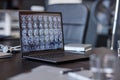 Open Laptop Showing X Ray Scan of Patients Brain on Meeting Table in Clinic Royalty Free Stock Photo