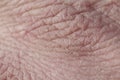 background with the texture of weathered human hand skin covered with deep wrinkles and dry scales and cracks