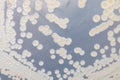 Backgrounds of Characteristics and Different shaped Colony of Bacteria and Mold growing on agar plates.