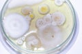 Backgrounds of Characteristics and Different shaped Colony of Bacteria and Mold growing on agar plates .