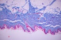 Characteristics Tissue of Human scalp, Skin human from general body surface and showing sweat glands under microscope.