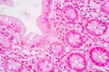 Tissue of Stomach Human, Small intestine Human, Pancreas Human and Large intestine Human under the microscope. Royalty Free Stock Photo