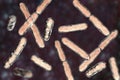 Bacteria Bifidobacterium, gram-positive anaerobic rod-shaped bacteria which are part of normal flora of human intestine