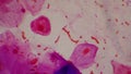 Bacteria cell Gram neagative bacilli with capsule pathogen.Sample sputum in Gram stain method Royalty Free Stock Photo