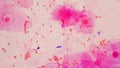 Bacteria cell Gram neagative bacilli with capsule pathogen.Sample sputum in Gram stain method Royalty Free Stock Photo