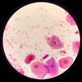 Bacteria cell Gram neagative bacilli with capsule.Sample sputum in Gram stain method Royalty Free Stock Photo