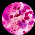 Bacteria cell Gram neagative bacilli with capsule.Sample sputum in Gram stain method Royalty Free Stock Photo