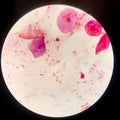 Bacteria cell Gram neagative bacilli with capsule.Sample sputum in Gram stain method Royalty Free Stock Photo