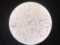 Bacteria cell in gram stain testing. Royalty Free Stock Photo