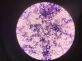 Bacteria cell in gram stain testing. Royalty Free Stock Photo