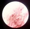 Bacteria cell in gram stain testing.