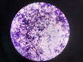 Bacteria cell in gram stain testing.