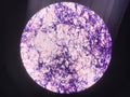 Bacteria cell in gram stain testing.