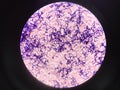 Bacteria cell in gram stain testing.