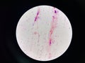 Bacteria cell in sputum sample Gram stain method