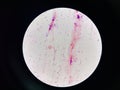 Bacteria cell in sputum sample Gram stain method Royalty Free Stock Photo