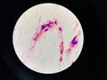 Bacteria cell in sputum sample Gram stain method Royalty Free Stock Photo