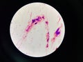 Bacteria cell in sputum sample Gram stain method