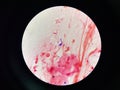 Bacteria cell in sputum sample Gram stain method Royalty Free Stock Photo