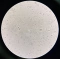 Bacteria cell in urine with white blood cell Royalty Free Stock Photo