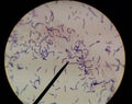 Bacteria cells finding with microscope.